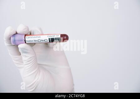 Main portant un gant en latex tenant un tube rempli de sang sur un fond blanc. Concept de coronavirus. Banque D'Images