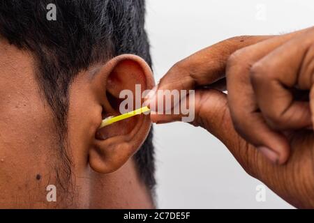 Retirez la cire d'oreille en toute sécurité - un homme nettoie l'oreille avec des cotons-tiges gros plan. Oreille de nettoyage avec un coton-tige oreille sale. Retirer la cire d'oreille à l'aide d'un coton-tige Banque D'Images