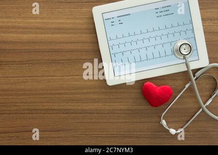 Cardiogramme, ecg, électrocardiogramme coeur montrant dans un ordinateur de tablette et stéthoscope sur le bureau du médecin. Concepts de cardiologie et de contrôle médical. À Banque D'Images