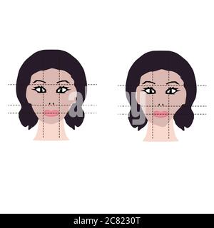 Asymétrie de face. Défaut esthétique. Dents mal mordiées Illustration de Vecteur