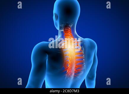 3d a rendu médicalement l'illustration précise d'un homme ayant un cou douloureux. Banque D'Images