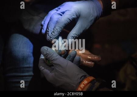 PORTLAND, OR - JUILLET 26 : une image rapprochée de l'application de crème brûlée alors que les manifestants s'opposent aux officiers de la protection fédérale en dehors du palais de justice américain Mark O. Hatfield le 26 juillet 2020 à Portland, Oregon. Photo : Chris Tuite/imageSPACE/MediaPunch Banque D'Images