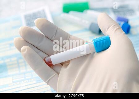 Main avec un gant médical de scientifique ou de médecin tient le test tube avec échantillon de sang et étiquette vierge pour le texte propre sur le fond de la table avec le médical Banque D'Images