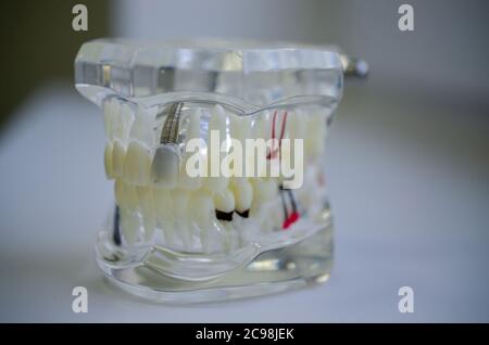 Faites une maquette d'un échantillon de la mâchoire supérieure et inférieure dans le cabinet du dentiste Banque D'Images