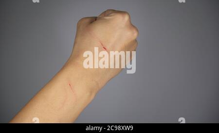 Main d'une femme dans un poing rayé par un chat sur fond gris. Banque D'Images