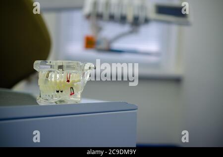 Faites une maquette d'un échantillon de la mâchoire supérieure et inférieure dans le cabinet du dentiste Banque D'Images