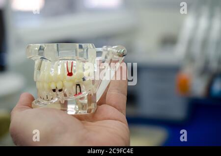 Faites une maquette d'un échantillon de la mâchoire supérieure et inférieure dans le cabinet du dentiste Banque D'Images