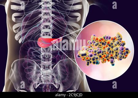 Pancréas humain et vue rapprochée de la molécule d'insuline, illustration informatique. Banque D'Images