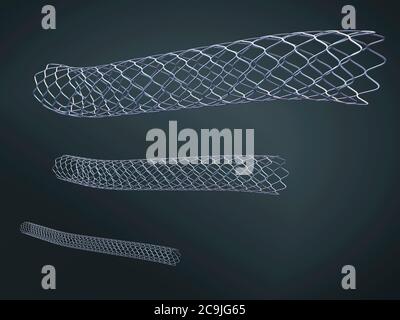 illustration 3d de trois stents métalliques pour implantation dans les vaisseaux sanguins. Banque D'Images