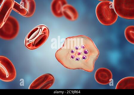 Plasmodium ovale protozoaire à l'intérieur des globules rouges, illustration informatique. P. ovale est l'agent causal du paludisme tertien Bénin, également connu sous le nom d'ovules Banque D'Images