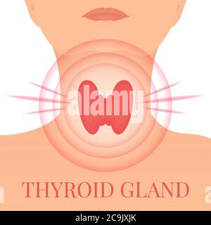 Maladie de la glande thyroïde, illustration conceptuelle. Banque D'Images