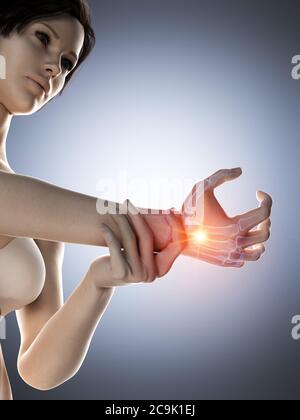 Femme avec une main douloureuse, illustration. Banque D'Images