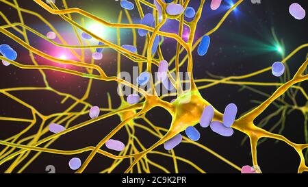 Encéphalite bactérienne. Illustration informatique conceptuelle montrant les bactéries infectant les cellules du cerveau. Banque D'Images