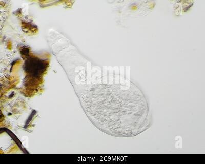 Rutifer à bdelloïde avec un mastax clairement visible, d'un échantillon d'eau de boudin de jardin, le champ de vision horizontal est d'environ 0.24mm Banque D'Images
