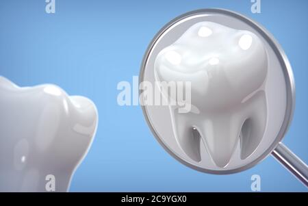 Modèle dentaire de dent et d'équipement dentaire, rendu 3d sur fond bleu. illustration 3d comme un concept de l'examen dentaire dents, la santé dentaire an Banque D'Images