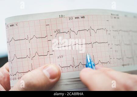 Électrocardiogramme dans les mains du médecin. Banque D'Images