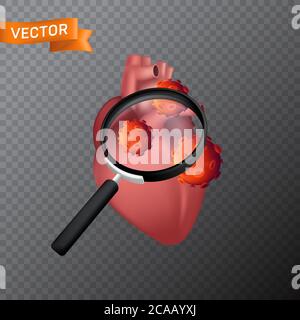 Cœur humain sous une loupe avec des cellules virales. Vecteur médical illustration de la recherche de virus ou de la recherche dans l'organe interne avec une loupe i Illustration de Vecteur