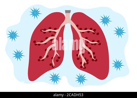 Signe Infographie avec le dessin animé a toux, fièvre, mal de gorge et froid dans le coronavirus ou Covid-19 éclosion. Illustration de Vecteur