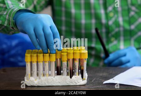 Le personnel médical tient des échantillons de sang pendant les tests.les travailleurs de la santé indienne effectuent des tests sérologiques sur les anticorps générés par le système immunitaire contre le coronavirus. En Inde, plus de 55,000 cas s'ajoutent chaque jour, avec un total de 1964,536 cas confirmés et 40, 699 décès par les maladies COVID-19. Banque D'Images