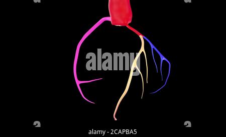Image de rendu 3D de l'artère coronaire CTA colorée ou illustrations 3d de l'arbre coronaire sur fond noir. Masque Banque D'Images
