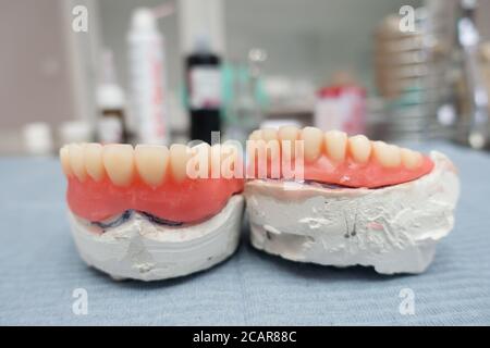 prothèses dentaires amovibles complètes sur les modèles de gypse dans la fabrication processus Banque D'Images