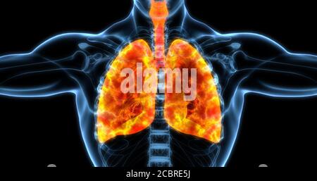 Poumons humains illustration médicale montrant les poumons infectés en orange vif. Illustration 3D Banque D'Images
