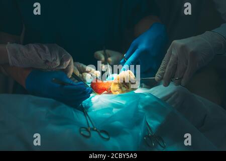 Close up detail d'une chirurgie. Groupe d'exploitation au travail des chirurgiens en chirurgie, dans le théâtre. Banque D'Images