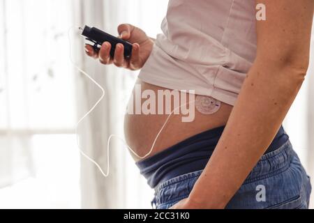 La femme enceinte utilise une pompe à insuline. Traitement moderne du diabète par l'insuline donnée par un drainage monté sur le ventre. Banque D'Images