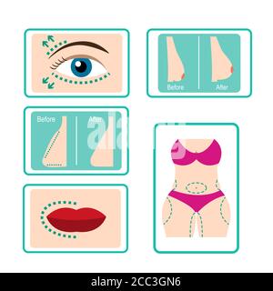 Icône de chirurgie en plastique définie avec des marquages chirurgicaux plats L'image du visage et du corps avant et après la chirurgie Illustration de Vecteur