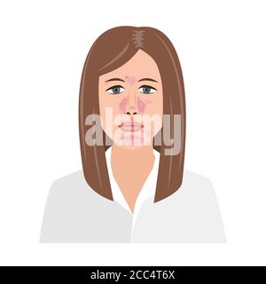 Femme malheureuse souffrant de dermatite séborrhéique. Illustration vectorielle. Visage adulte ou adolescent présentant des problèmes de peau sur fond blanc isolé Illustration de Vecteur