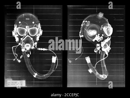 Casques de pilotage, rayons X. Banque D'Images