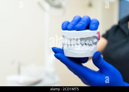 Belle fille médecin professionnel dentiste orthodontiste montre un plâtre de la mâchoire. Banque D'Images