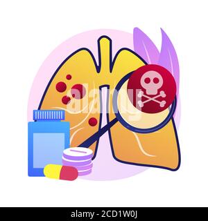 Illustration du vecteur de concept abstrait des infections des voies respiratoires inférieures. Illustration de Vecteur