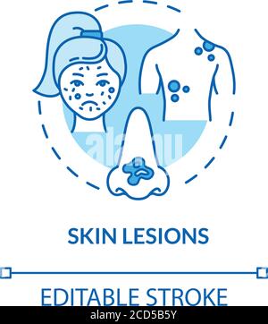 Icône de concept lésions cutanées Illustration de Vecteur