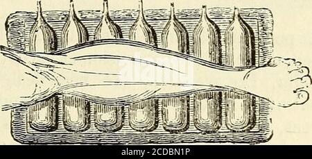 . Manuel de petite chirurgie . Fig. 153. Fig. Ibà. Placé dans cette boîte, ne les coussins sont pas des vides, puis ces Î ! ? ? î î. Système 155.derniers sont suffisants jusquà ce que le membre soit suffisam- Banque D'Images