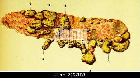 . Un guide pratique pour l'inspection de la viande . FiO. 22.—tubercule Miliaire de PL^ra.pièce de poumon—vue externe—avec les masses limolaires de Tubercleconnectées ensemble par le baudK ttbrineux. FIA. 23.—partie de la bordure inférieure du poumon de vache, montrant— a. 0.0. SessileMassesonthesurfaceofla plèvre. b. b. Masses pédonculées provenant de la plèvre à l'extrême-bor-der—Dr. Crichtons festbous. Banque D'Images