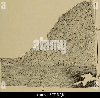 . Les éléments de l'histologie pathologique avec une référence spéciale aux méthodes pratiques . e :—(a) artériosclérose d'Atheror)iaor {endartériite chronique).— Ce processus implique soit l'ensemble du système artériel, soit est limité aux zones isolées seulement L'ATHEROMA 205 (aorte, artères du cerveau, reins et coeur), mais dans les deux cas chiefyaltère affecte les points où les branches se détaissent. Sa cause probatelse dans une diminution de l'élasticité de la paroi du vaisseau provoquée par des perturbations générales de la nutrition (âge avancé, alcoolisme, etc.), qui est ensuite suivie par une augmentation de l'expansion de la TH Banque D'Images