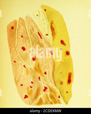 . Un guide pratique pour l'inspection de la viande . FiO. 4,—intérieur du ventricule gauche du cœur, montrant une extravasation sanguine dans la fièvre porcine. Figure 3.—un morceau de chair des Quartersde Hind d'un Cow Icilleil pendant l'acte de parturition, montrant la couleur sombre et l'aspect irrideacent doucement vu dans les maladies du sang congestif, l'inflémiatibn, et la fièvre. Figure 5.—Section à travers le muscle de Pig(Swmc Fever), showingextravasation du sang iuto le muscle, le tissu conjonctif, et la graisse. Banque D'Images