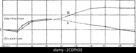 . Conférence Croonienne : le processus respiratoire dans le muscle et la nature du mouvement musculaire . Hou/fs 3 f/?0M fXC/S/O/V Fig. 3.—-changements de longueur d'une paire de gastrocnemii excisés, après fatigue. Les coordonnées sont mesurées directement à partir de l'enregistrement sur le tambour. Les leviers sont agrandis 6-| fois. grm Load3 Temp. 23 °C. A. exposé à l'oxygène. B. exposé à l'air. Figure 4.—changements de longueur d'une paire de gastrocnemii excisés, après fatigue. Coordonnées et agrandissement comme illustré sur la fig. 3. Charge, 3 grm. Temp. 16 °C. A. exposé à l'oxygène.B. Exposé à l'air. Du Journal of Physiology, vol. 28, p. 479 (1902). Maintenant l Banque D'Images