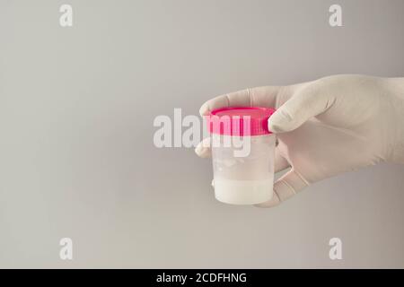 Tests de liquide mâle dans la main d'un médecin en gants blancs. Banque D'Images