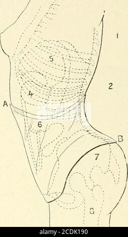 . Les seins dans l'histoire . Figure 186 hi.s. — lia|)|)i)i-ls du cursil hal)i(iul el du modèle prrcoiisrpai M&gt;= Gaches-Sarrauto (:2). ni exil, lait allusion à cette mode prohibitif de lembonpointababdominal qui avantage le haut et ntrécit le bas : La Femme alors supprima ses viscères,plus dappetits, surtout plus de petits...Ah! Sanglez bien vos entrailles de mères.dans les corsets de Monsieui- l.ioty ! Le crayon malicieux de E. Barcet (apujdt ndvndo le même méostracisme : une clique se laint cà son docteur de souffrir : « — Pourquoi, réétang lhomme de lart, nessavez-vous ili Anecil. Banque D'Images