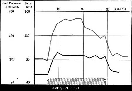 . L'étude clinique de la pression artérielle : un guide de l'utilisation du sphygmomanomètre dans la pratique médicale, chirurgicale, et obstétricale, avec un résumé des faits expérimentaux et cliniques relatifs à la pression artérielle dans la santé et dans la maladie . te, l'effet de l'effort sur la pression aortique moyenne. Ici, comme ailleurs, la détermination des bothpressions serait plus utile pour éclairer les vascularisations réelles. Les indications fournies par l'augmentation du volume d'impulsion, dans le cas présent, pointent clairement vers une augmentation de l'énergie du cœur comme au facteur de la leasone dans l'augmentation de la pression, si n Banque D'Images