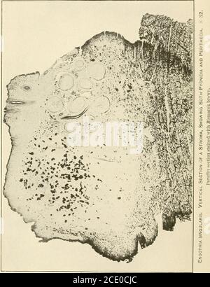 . Endothia parasitica et espèces apparentées . mm ENDOTHIA GYROSA. VERTICAL SECTIONSBEECH. X32. DE STROMA SUR FIQ. 1.—montrant de nombreuses cavités pycnidiales et TWo périthecia mature.Fig. 2.—montrant côte à côte des pycnides et des périthéces matures. Sauf indication contraire, les photomicrographes de stromata sont issus de coupes non coloréescoupées avec un microtome de congélation. Bui. 380, Département de l'agriculture des États-Unis. Plaque XII. ENDOTHIA PARASITICA ET LES ESPÈCES APPARENTÉES. 25 capable d'absorption, une puissance qu'il conserve relativement perma-nently. En plus de sa fonction d'absorption, l'entostroma formsle pseudo Banque D'Images