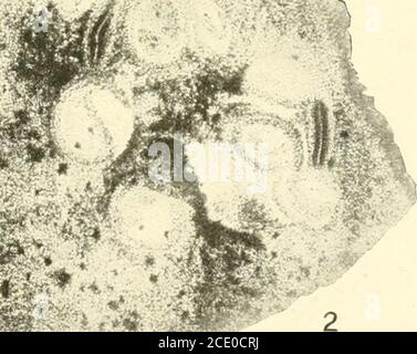 . Endothia parasitica et espèces apparentées . Il*. -. Mm ENDOTHIA GYROSA. VERTICAL SECTIONSBEECH. X32. DE STROMA SUR FIQ. 1.—montrant de nombreuses cavités pycnidiales et TWo périthecia mature.Fig. 2.—montrant côte à côte des pycnides et des périthéces matures. Sauf indication contraire, les photomicrographes de stromata sont issus de coupes non coloréescoupées avec un microtome de congélation. Bui. 380, Département de l'agriculture des États-Unis. Plaque XII Banque D'Images