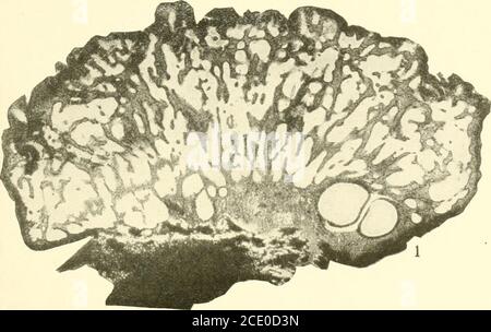 . Endothia parasitica et les espèces apparentées. rom mycélium) est la somme totale de la partie de la partie du corps du champignon qui, sans servir ex-clusivement pour l'absorption, participe à la formation du corps fruité. Il met de côté Fuistings (36, p. 185) division du corps fongicide en un épistrome et un hypostroma, car essentiellement rien ne fait obstacle à la distinction des couches conidiales et du stroma périthécial. Ruhland divise le corps du champignon en ectostroma et en ento-stroma. L'ectostroma pousse sur la surface supérieure du paren-chyma de l'écorce, entre elle et le périderme, et est com Banque D'Images