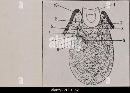 . Journal de l'Institut de Stomatologie de New York, American Academy of Dental Science, Harvard odontological Society et le Metropolitan District (Mas . le développement occasionnel d'un kyste multiloculaire comme forme de récurrence après theremoval d'autres variétés de kystes. Comme le lias a été dit, les caractéristiques structurales et cliniques des kystes présentent des différences marquées. Le kyste dentifrice, je Fig. VII &gt;, qui est parfois le kyste folliculaire de la calleda en raison de la théorie selon laquelle il arisesthrough dilatation d'un follicule d'un rudimentaire ou surnumer- THE JOURNAL. dent 237 ary, Banque D'Images