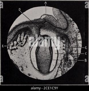 . Journal du New York Institute of Stomatology, American Academy of Dental Science, Harvard odontological Society et le Metropolitan District (Mas . ular, andadamantine. Tous ces éléments ont en commun une caractéristique importante et essentielle, c'est-à-dire qu'ils sont dans la structure de la délation épithéliale et le type. Pourtant, en dépit de cette similitude, ils doivent beregared cliniquement comme des processus différents; le kystspessent dentieux marqué particularités individuelles; l'uniloculaire sont distinctically unique; et seulement le multiloculaire et adamantine peut beconsibrasé ensemble comme étroitement liés. Avant discu Banque D'Images