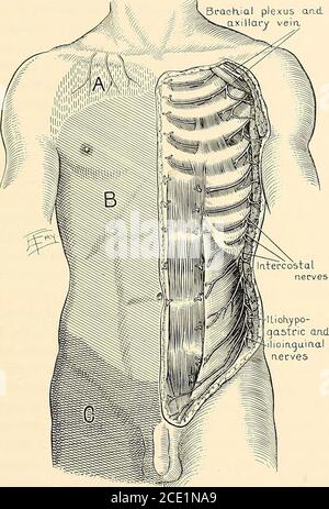 . Anesthésie régionale : son application technique et clinique . sur de tels symptômes toxiques il est advisableto faire des injections paravertébrales à une distance d'environ 1 cm. De la thespine, et surtout, pour s'assurer que l'injection n'est pas faite dans le flux sanguin. Anesthésie.—l'anesthésie suivant l'injection du seul nerf onéthoracique est illusoire, puisque les branches cutanées des nerfs contigeurschevauchent l'espace intercostal fourni par ce nerf; et, sans compter, le liquide anesthésique est distribué par voie sous-cutanée le long de l'espace intercostalinal, ou injection faite d'au moins un nerf au-dessus et un Banque D'Images