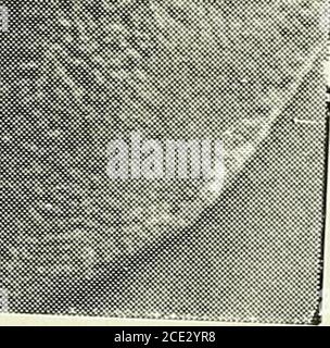 . Cent ans de médecine et de chirurgie au Missouri; revue historique et biographique des carrières des médecins et chirurgiens de l'état du Missouri, et croquis de certaines de ses institutions médicales remarquables. O. TORREY, 1874. IILSLI1. Banque D'Images