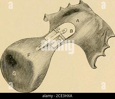 . Un manuel de la dentisterie mécanique et de la métallurgie . plaque exactement à la bouche, construire sur ce projectiona bulbe composé de la composition de modélisation; construire ceci, OliTTK VlORS ET AKTIFICIAI. i:LR.M. 125 aussi près que possiljlc. À lu la fissure dans le palais snfi, l'éryplate et le taureau) à la position dans la bouche; noter les changements qui doivent être faits dans la forme de ce dernier; Retirez et retirez les garnitures jusqu'à ce que la forme et l'adaptation souhaitées soient fixées. Le boîtier est alors prêt à être posé, emballé et vulcanisé. La plaque, comme illustré en Fig. 79 et 80, couvre l'ensemble du palais dur, de ses Banque D'Images